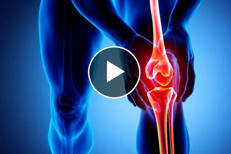 Knee XRays 2
