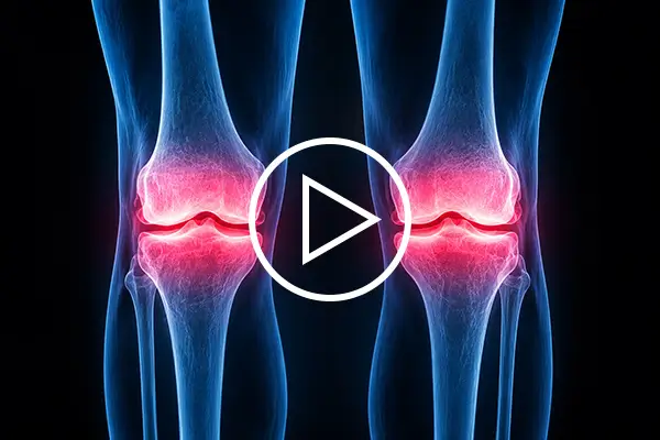 Two-Knee-Xrays600px